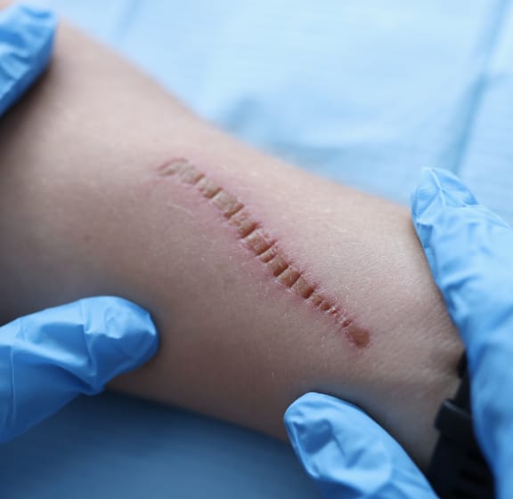 Clinician examining a healed surgical scar